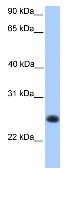 Anti-C12orf68 antibody (ab81493) at 1 µg/ml (in 5% skim milk / PBS buffer) + human fetal muscle lysate at 10 µgSecondaryHRP conjugated anti-Rabbit IgG at 1/50000 dilution