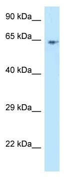 Anti-C13orf18 antibody (ab118768) at 1 µg/ml + Jurkat cell lysate at 10 µg