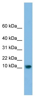 Anti-C13orf30 antibody (ab103705) at 1 µg/ml + MCF7 Cell Lysate at 10 µg