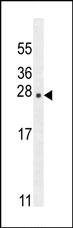 Anti-C13orf33 antibody (ab107314) at 1/100 dilution + Mouse liver tissue lysates at 35 µg