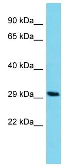 Anti-C14orf105 antibody - C-terminal (ab157612) at 1 µg/ml + HCT15 whole cell lysate at 10 µg