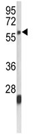 Anti-C14orf118 antibody - C-terminal (ab95009) at 1/100 dilution (TTBS/1% NFDM for 1 hr. at room temperature.) + K562 cell line lysate at 35 µgSecondaryEnzyme-linked secondary antibody (typically horseradish peroxidase or alkaline phosphatase) in TTBS/1% NFDM for 30 min. at room temperature.