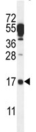 Anti-C14orf126 antibody (ab107342) at 1/199 dilution + Mouse lung tissue lysates at 35 µg