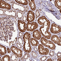 Immunohistochemical analysis of paraffin-embedded Human kidney tissue labeling C1orf142 with ab151146 at 1/500 dilution.