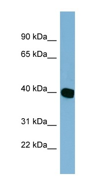 Anti-C14orf148 antibody (ab98324) at 1 µg/ml + HT1080 cell lysate at 10 µg