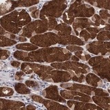 ab121114 at 1/60 dilution staining C14orf151 in Paraffin-emebedded Human stomach tissue by Immunohistochemistry. Note: strong cytoplasmic positivity in glandular cells.