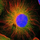 Immunofluorescent staining ofC14orf151 in U-251MG cells using ab12114 at a concentration of 4 µg/ml. Note: shows positivity in nucleus & cytoplasm.