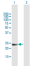 All lanes : Anti-C14orf151 antibody (ab169638) at 1 µg/mlLane 1 : C14orf151 transfected 293T cell lysateLane 2 : Non-transfected 293T cell lysateLysates/proteins at 15 µl per lane.developed using the ECL technique