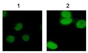 Immunofluorescent staining of Human melanoma cells, using Rabbit polyclonal to acetyl Lysine (ab21623) at 1:100 dilution.1: Untreated cells2: TSA treated cells