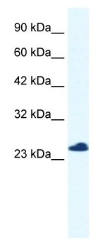 Anti-C14orf166 antibody (ab49342) at 0.125 µg/ml + Jurkat cell lysate at 10 µgSecondaryHRP conjugated anti-Rabbit IgG at 1/50000 dilution