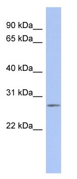 Anti-C14orf166 antibody (ab94463) at 1 µg/ml (in 5% skim milk / PBS buffer) + Human fetal thymus lysate at 10 µgSecondaryHRP conjugated anti-Rabbit IgG at 1/50000 dilution