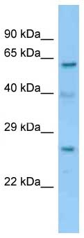 Anti-C14orf166 antibody (ab128365) at 1 µg/ml + Mouse Liver Lysate at 10 µg