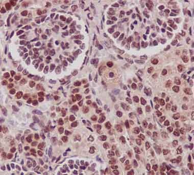Immunohistochemical analysis of paraffin-embedded human fetal kidney tissue labeling C14orf166 using ab188326 at 1/100 dilution. A ready to use HRP polymer for rabbit IgG (prediluted) was used as secondary. Counterstain: Hematoxylin.