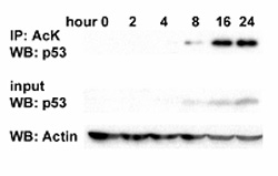 p53 acetylation upon Doxorubicin treatment in human melanoma cells (MMRU cells). MMRU cells were treated with 0.5 ug/ml Dox for various times and lyzed for whole protein. Immunoprecipitation was performed with ab21623. Western blot was performed to detect the immunoprecipitated p53 with anti-p53 antibody.
