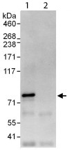 Detection of C14orf169 / NO66 in Immunoprecipitates of HeLa whole cell lysate (1 mg for IP, 20% of IP loaded) using ab113975 at 6 µg/mg lysate for IP (Lane 1) and at 0.4 µg/ml for subsequent Western blot detection. Lane 2 represents control IgG IP. Detection: Chemiluminescence with an exposure time of 30 seconds.