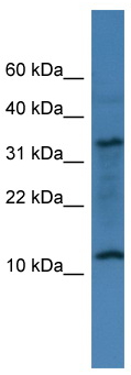 Anti-C14orf177 antibody (ab112082) at 1 µg/ml + 721_B cell lysate at 10 µg