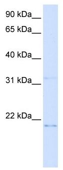 Anti-C14orf180 antibody (ab105839) at 1 µg/ml + C14orf180 transfected 293T cell lysate at 10 µg