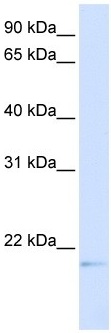 Anti-C14orf180 antibody (ab105840) at 1 µg/ml + Transfected 293T Cell Lysate at 10 µg