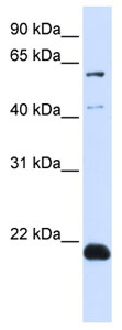 Anti-C14orf180 antibody (ab106154) at 1 µg/ml + C14orf180 transfected 293T cell lysate at 10 µg
