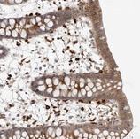 ab121983, at a 1/150 dilution, staining C1orf158 in paraffin-embedded Humam colon tissue, by Immunohistochemistry.