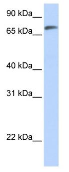 Anti-C14orf37 antibody (ab83781) at 1 µg/ml (in 5% skim milk / PBS buffer) + Human fetal lung lysate at 10 µgSecondaryHRP conjugated anti-Rabbit IgG at 1/50000 dilution