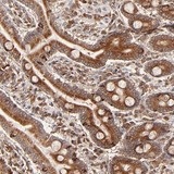 ab121172 at 1/150 dilution staining C14orf45 in Paraffin-emebedded Human duodenum tissue by Immunohistochemistry.