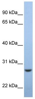 Anti-C15orf24 antibody (ab81132) at 1 µg/ml + fetal muscle lysate at 10 µgSecondaryHRP conjugated anti-Rabbit IgG at 1/50000 dilution