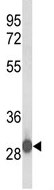 Anti-C15orf29 antibody (ab103283) at 1/100 dilution + CEM cell lysate at 35 µg
