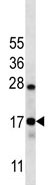 Anti-C15orf40 antibody (ab113047) at 1/100 dilution + Ramos cell line lysates at 35 µg