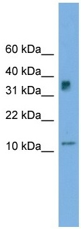 Anti-C15orf40 antibody (ab105716) at 1 µg/ml + C15orf40 transfected 293T cell lysate at 10 µg