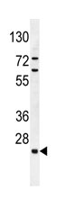 Anti-C15orf41 antibody (ab107352) at 1/100 dilution + K562 cell line lysates at 35 µg