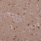 Immunohistochemical analysis of paraffin-embedded Human lateral ventricle tissue labeling C15orf60 with ab150881 at 1/500 dilution.