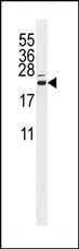 Anti-C16orf13 antibody (ab107610) at 1/100 dilution + CHO cell line lysate at 35 µg