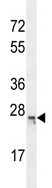 Anti-C16orf45 antibody (ab107569) at 1/100 dilution + NCI-H460 cell line lysates at 35 µg