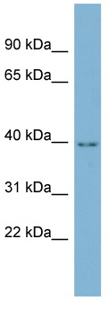 Anti-C16orf48 antibody (ab98316) at 1 µg/ml + THP1 cell lysate at 10 µg