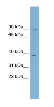 Anti-C16orf48 antibody (ab98323) at 1 µg/ml + PANC1 cell lysate at 10 µg
