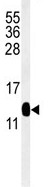 Anti-C16orf61 antibody (ab104301) at 1/100 dilution + Mouse kidney tissue lysate at 35 µg