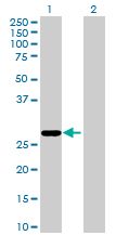 All lanes : Anti-C16orf65 antibody (ab169257) at 1/500 dilutionLane 1 : C16orf65 transfected 293T cell lysateLane 2 : Non-transfected 293T cell lysateLysates/proteins at 15 µl per lane.developed using the ECL technique
