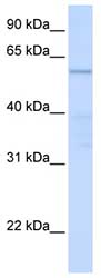 Anti-C16orf71 antibody (ab83035) at 1 µg/ml (in 5% skim milk / PBS buffer) + Human fetal heart lysate at 10 µgSecondaryHRP conjugated anti-Rabbit IgG at 1/50000 dilution