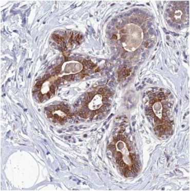 Immunohistochemical analysis of paraffin-embedded Human breast tissue labeling C16orf73 with ab150888 at 1/20 dilution.