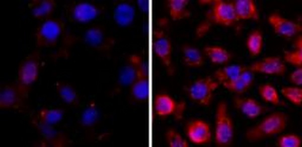 Immunofluorescent analysis of A431cells nontreated (left) or treated with Trichostatin A (right), using ab190479 at 1/500 followed by a PE conjugated secondary antibody (red) and DAPI (blue).
