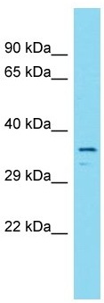 Anti-C16orf93 antibody - C-terminal (ab157675) at 1 µg/ml + Human fetal brain lysate at 10 µg