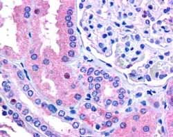 ab58580 (2.5 µg/ml) staining C17orf27 in human kidney by IHC-P.  Steamed antigen retrieval in citrate buffer pH 6, AP-staining.  The image shows rare staining of nucleoli across the kidney .