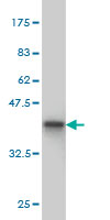 Western blot against tagged recombinant protein immunogen using ab57548 C17orf27 antibody at 1ug/ml.