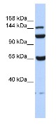Anti-C17orf57 antibody (ab85494) at 1 µg/ml (in 5% skim milk / PBS buffer) + 293T cell lysate at 10 µgSecondaryHRP conjugated anti-Rabbit IgG at 1/50000 dilution