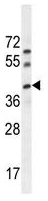 Anti-C17orf59 antibody (ab107310) at 1/100 dilution + HL60 cell line lysates at 35 µg