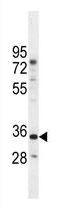 Anti-C17orf59 antibody (ab107310) at 1/100 dilution + Mouse bladder tissue lysates at 35 µg