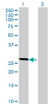 All lanes : Anti-C17orf66 antibody (ab69288) at 1/1000 dilutionLane 1 : transfected 293T lysateLane 2 : Non-transfected lysateLysates/proteins at 25 µg per lane.