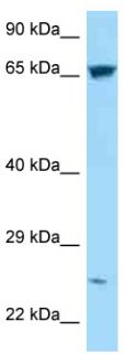 Anti-C17orf66 antibody (ab128632) at 1 µg/ml + 293T cell lysate at 10 µgdeveloped using the ECL technique