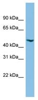 Anti-C17orf75 antibody (ab102561) at 1 µg/ml + HepG2 cell lysate at 10 µg